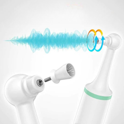 電動歯のデスケーラー - オーラル・ハイジーン＆ラディアント・スマイル